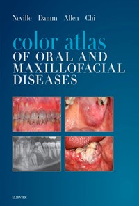 کتاب اطلس رنگی بیماری‌های دهان و فک و صورت نویل ۲۰۱۹ (زبان اصلی) اثر Brad W. Neville