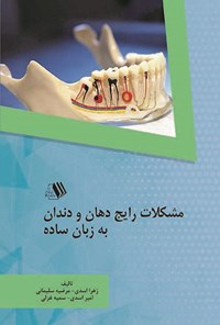 کتاب مشکلات رایج دهان و دندان به زبان ساده اثر زهرا اسدی